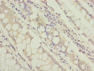 TCTA Antibody