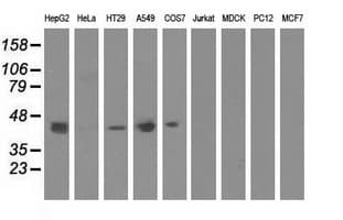 Monoclonal Mouse anti-Human CBWD1 Antibody (clone OTI2D2, IF, WB)