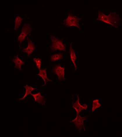 Polyclonal Rabbit anti-Human MASP2 / MASP-2 Antibody (IF, WB)
