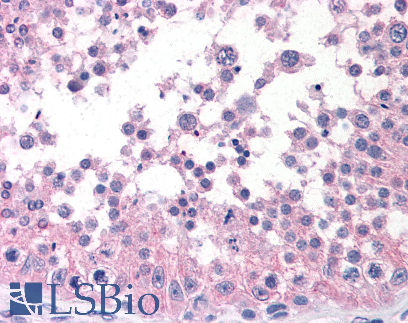 IHC-plus™ ATM Antibody (C-Terminus)