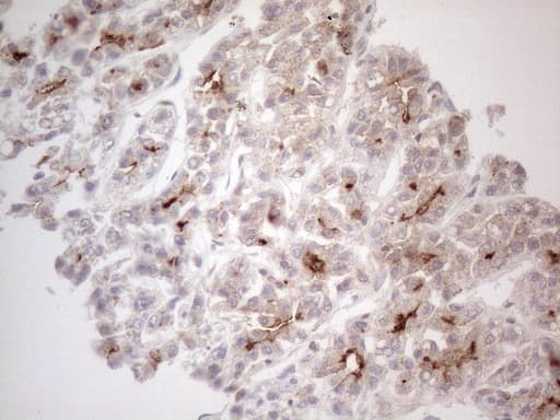 ABCB1 / MDR1 / P Glycoprotein Antibody (aa995-1280, clone OTI6E4)