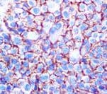 Melanoma Antibody (clone KBA.62)