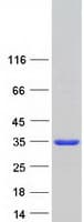 Human ASPDH Protein (Recombinant Myc-DDK (Flag))