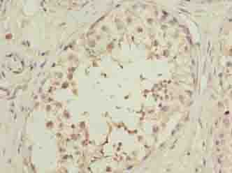 OOSP2 / PLAC1L Antibody
