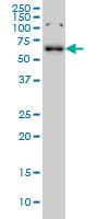 Monoclonal Mouse anti-Human CCDC6 Antibody (clone 5D11, WB)