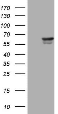 PAK4 Antibody (aa1-308, clone OTI3C3)