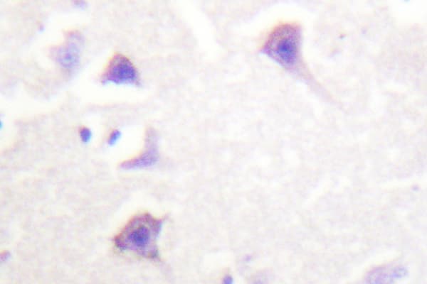 Polyclonal Rabbit anti-Human ERBB4 / HER4 Antibody (Glu1280, IHC, IF)