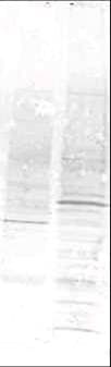 IHC-plus™ CAMK4 / CaMK IV Antibody