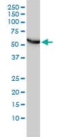 IHC-plus™ CCT5 / TCP1 Epsilon Antibody (clone 4E5-4B1)