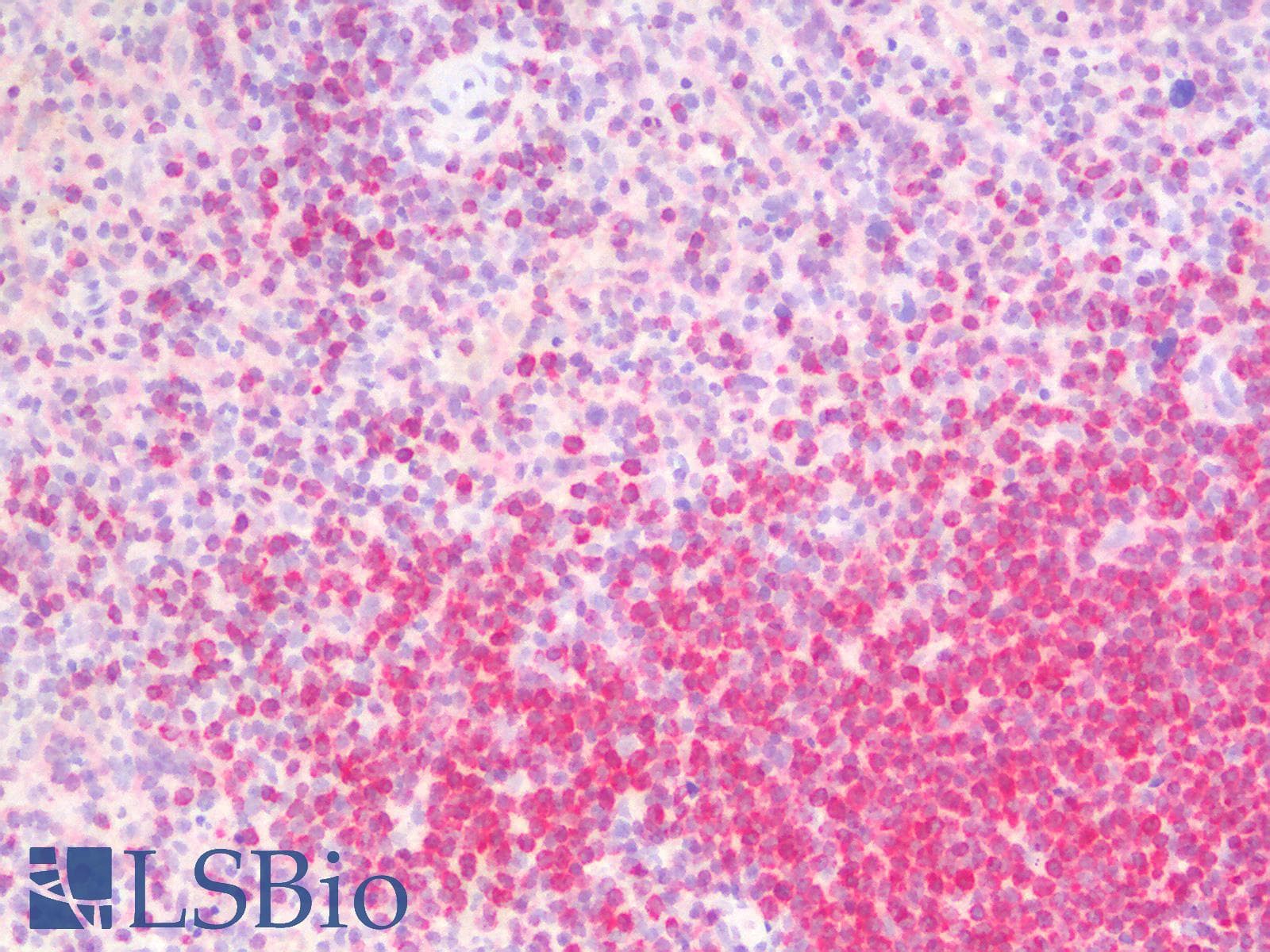 PathPlus™ BCL2 / Bcl-2 Antibody (clone BCL2/1878R)
