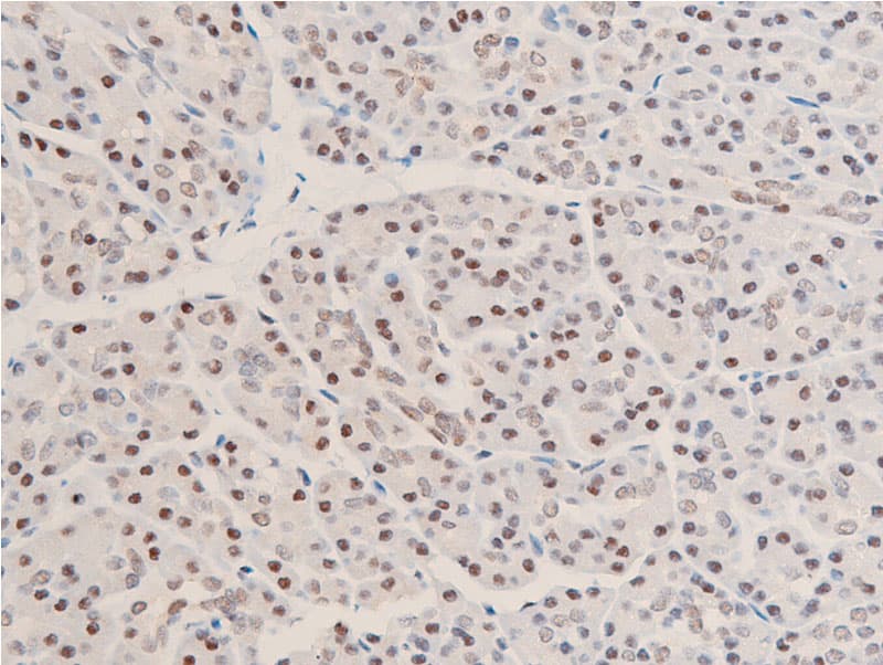 Polyclonal Rabbit anti-Human CHEK1 / CHK1 Antibody (phospho-Ser280, IHC, IF, WB)