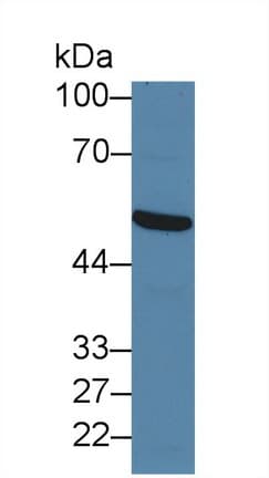 FOXP1 Antibody (aa461-671)