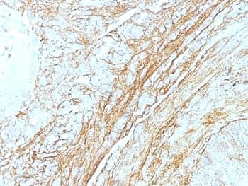 TNC / Tenascin C Antibody (clone T2H5)