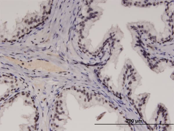Monoclonal Mouse anti-Human RECQL4 Antibody (clone 2G8, IHC)