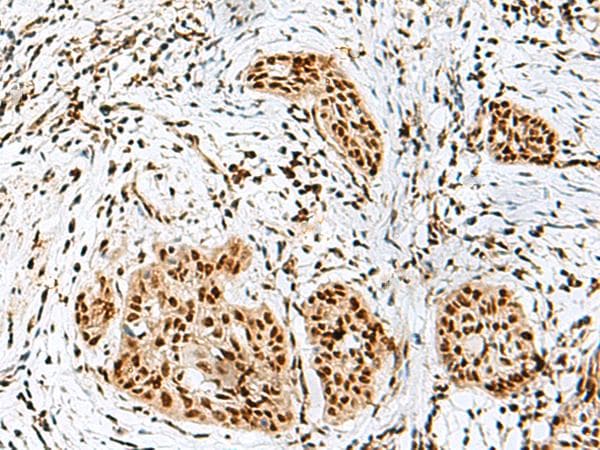 Polyclonal Rabbit anti-Human RBM10 Antibody (IHC)