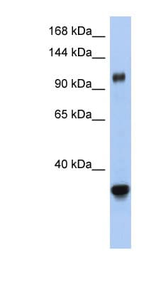 XPO5 / Exportin 5 Antibody (aa1115-1164)