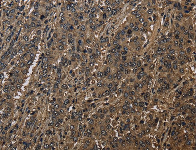 Polyclonal Rabbit anti-Human GSTO1 Antibody (IHC, WB)
