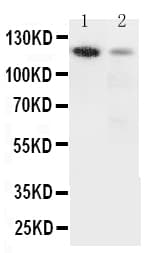 ITGA3 / CD49c Antibody (aa51-67)