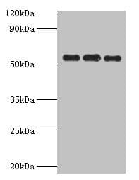 PDHX / Protein X / ProX Antibody (aa1-300)