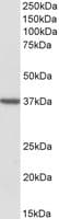 Polyclonal Goat anti-Human TOMM40 / TOM40 Antibody (aa117-130, WB)