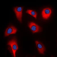 CDK5R2 Antibody (Internal)
