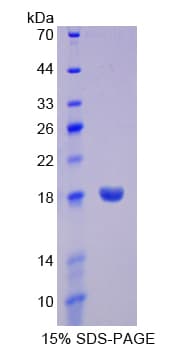 Human TNFRSF19 / TROY Protein (Recombinant His-T7)