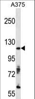 Polyclonal Rabbit anti-Human AXL Antibody (IHC, WB)