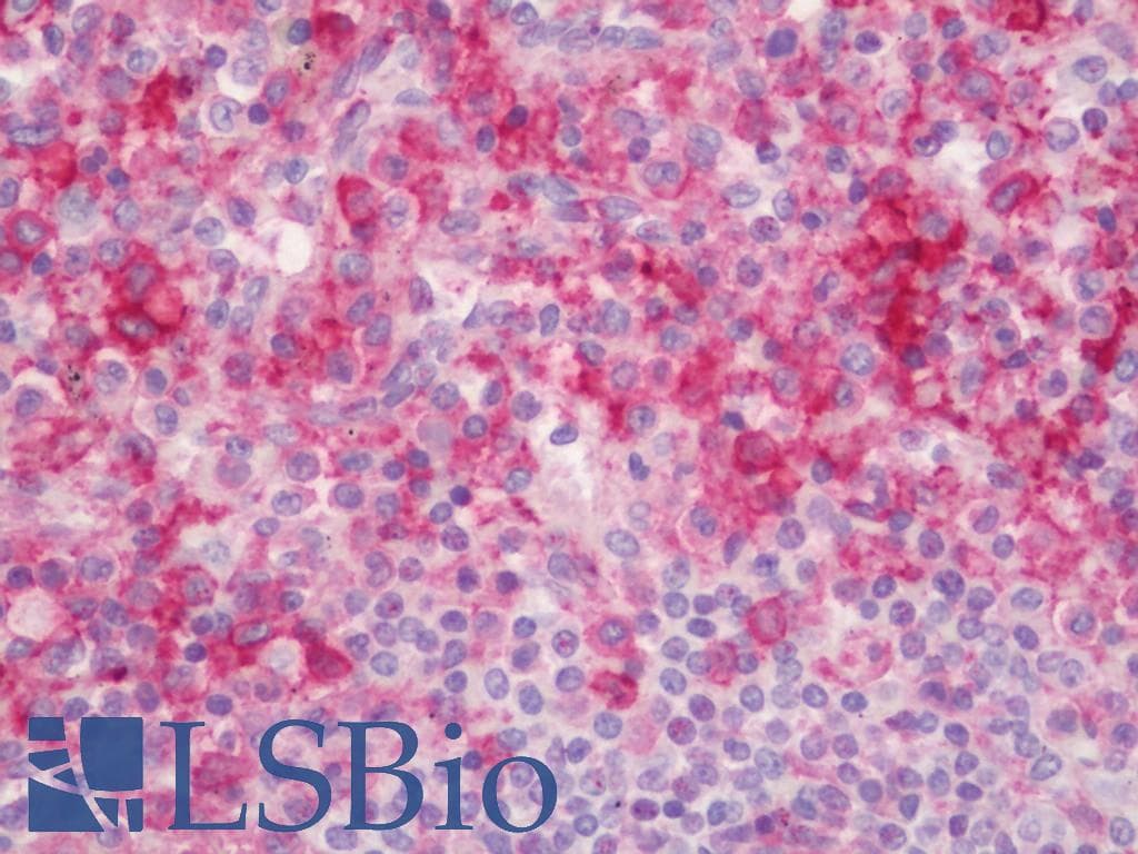 IHC-plus™ FCGR1A / CD64 Antibody (clone OTI1A8)