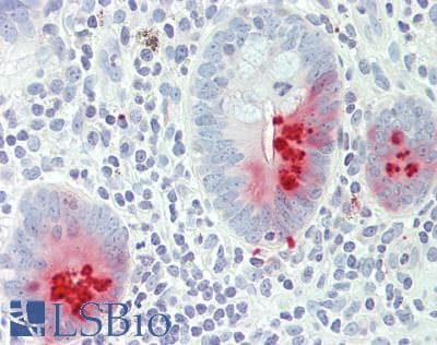 IHC-plus™ PRSS2 / Trypsin 2 Antibody