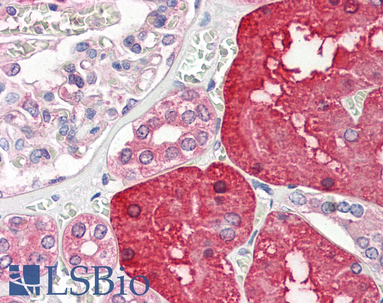IHC-plus™ ACY1 / Aminoacylase 1 Antibody