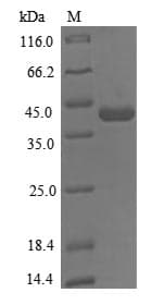 Human SH3YL1 Protein (Recombinant 6His, N-terminus)