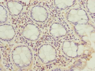 CFAP20 / GTL3 Antibody