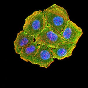 IHC-plus™ CCND1 / Cyclin D1 Antibody (clone 3B6G3)