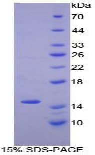 Human NUMB Protein (Recombinant His-T7)