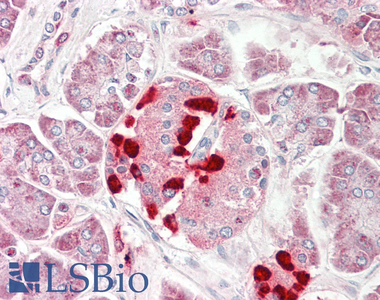 CS1 / CLSTN1 Antibody (aa35-84)