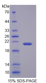 Rat IGF2 Protein (Recombinant His)