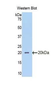 SLPI / Antileukoproteinase Antibody (aa20-131)