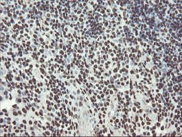 Monoclonal Mouse anti-Human NONO / P54NRB Antibody (clone OTI2E7, IHC, WB)