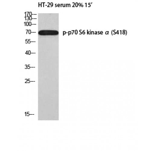 Polyclonal Rabbit anti-Human RPS6KB1 / P70S6K / S6K Antibody (360-440 aa, IHC, IF, WB)