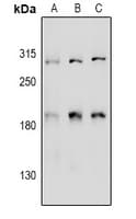 Polyclonal Rabbit anti-Human CCDC88A / GIV / Girdin Antibody (IHC, WB)