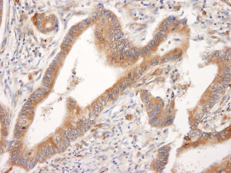 BID Antibody (aa60-120)