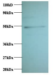CCL2 / MCP1 Antibody (HRP)
