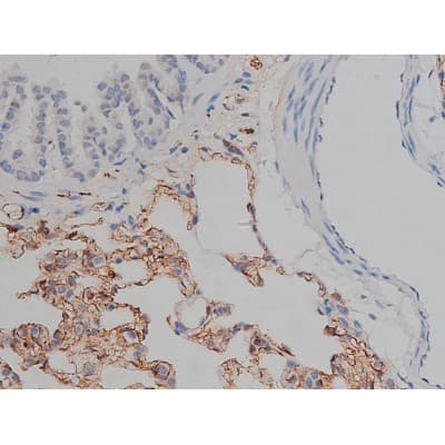 MAPT / Tau Antibody (phospho-Ser404)