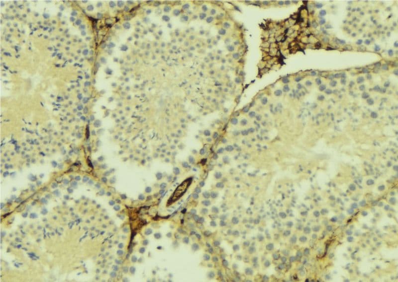 Polyclonal Rabbit anti-Human HELO1 / ELOVL5 Antibody (IHC, IF, WB)