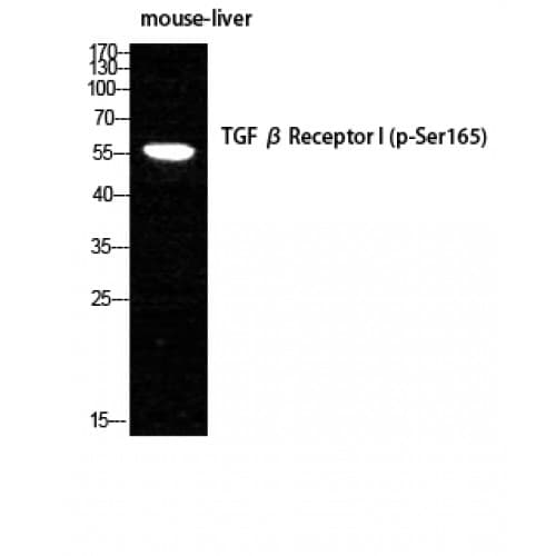 TGFBR1 / ALK5 Antibody (100-180 aa)