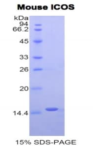Mouse ICOS / CD278 Protein (Recombinant His)