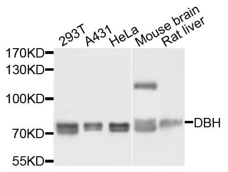 DBH/Dopamine Beta Hydroxylase Antibody
