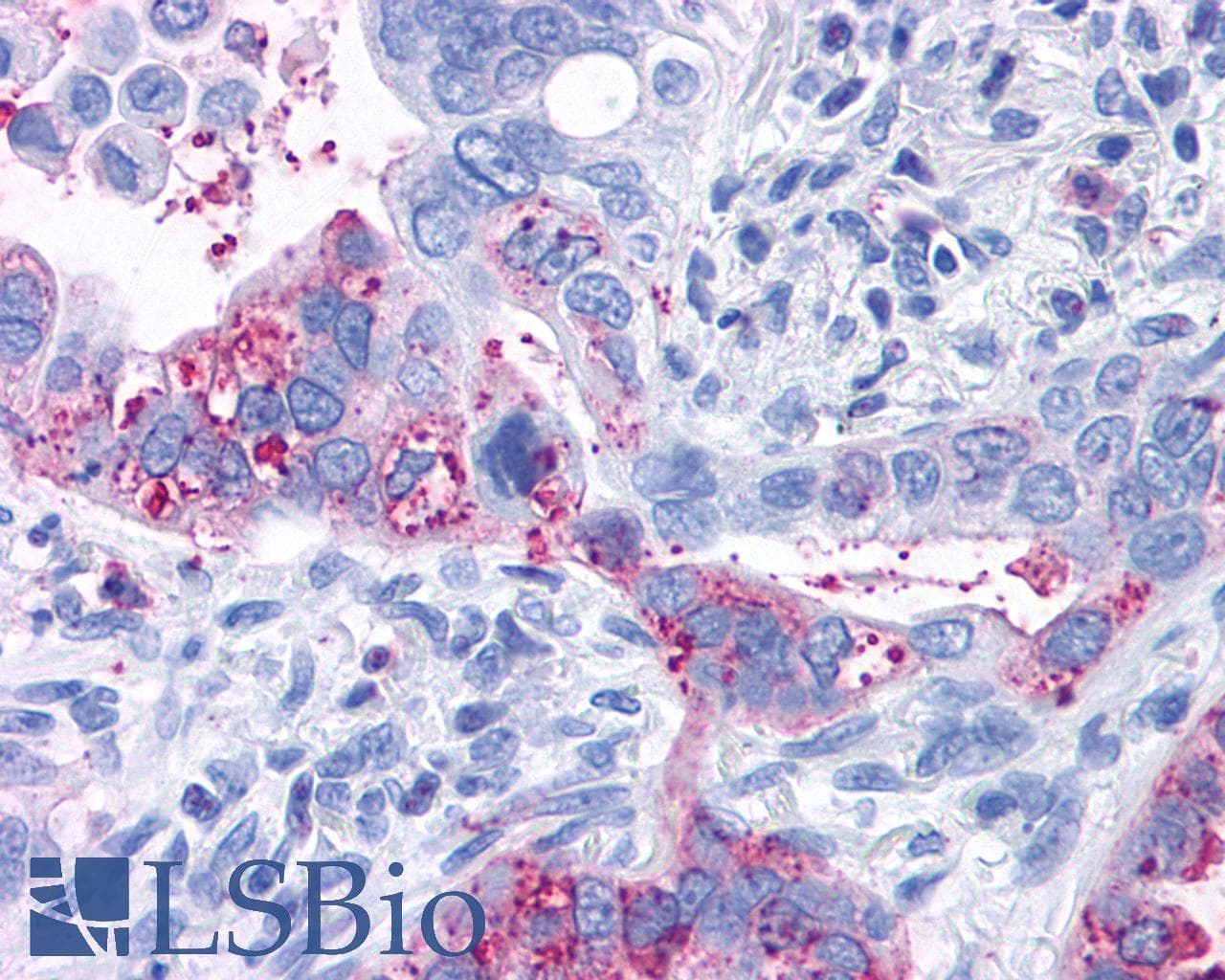 PathPlus™ Polyclonal Rabbit anti-Human GPR6 Antibody (Cytoplasmic Domain, IHC)