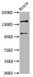 SOS1 Antibody