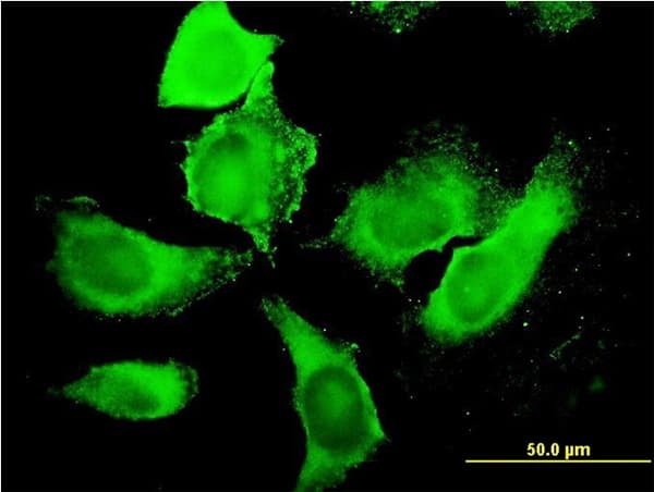 PIKFYVE / PIP5K Antibody (clone 6C7)